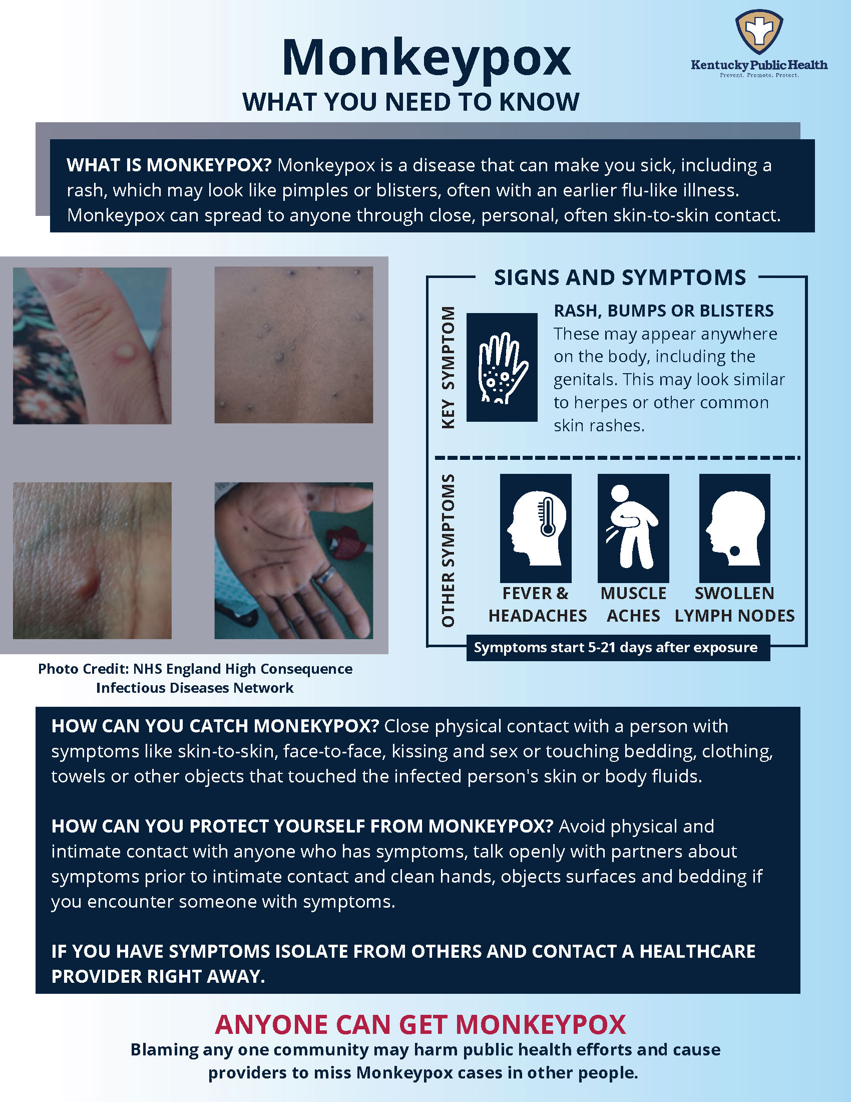 Mpox – Lexington-Fayette County Health Department